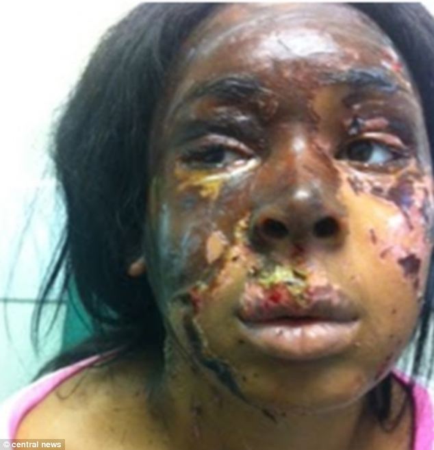 Изуродована