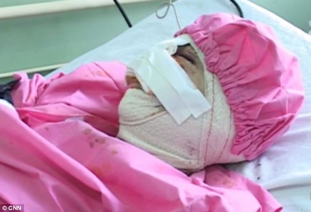 Афганец отрезал жене нос и губы -ФОТО+ВИДЕО
