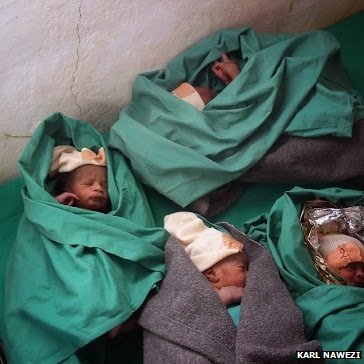 The quadruplets born to refugees fleeing their home - PHOTO
