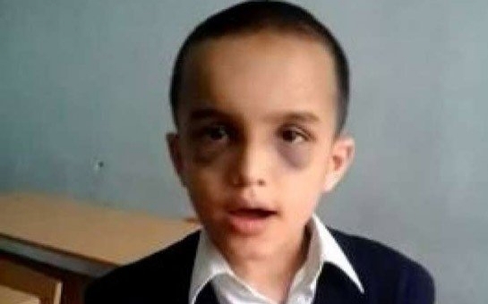 7 yaşlı Nihad: “Afaq müəllimə başıma taxta ilə vurdu” - VİDEO