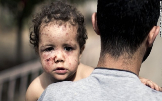 For children of Gaza, trauma can be worse than war itself