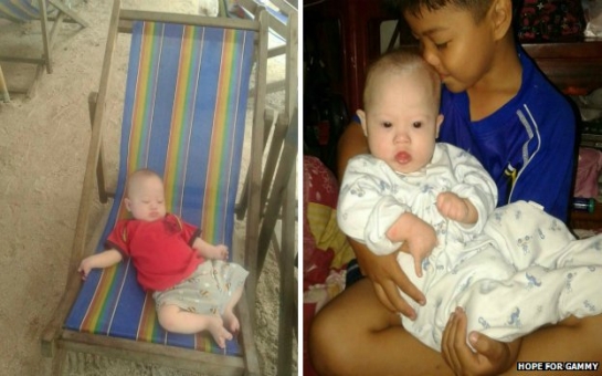 Australian couple abandon surrogate Down's Syndrome baby