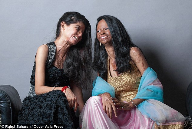Acid attack survivors unite for inspirational fashion shoot - PHOTO