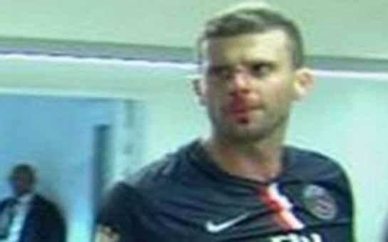 Thiago Motta head-butted