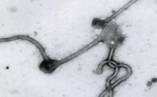 Several persons in Azerbaijan call “hotline” on suspicion of Ebola virus