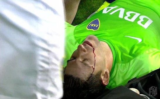 Goalkeeper struck by rock thrown by fans in shocking incident