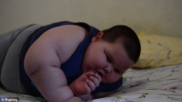 Ребенок весит 70 килограмм в 3 года - ФОТО