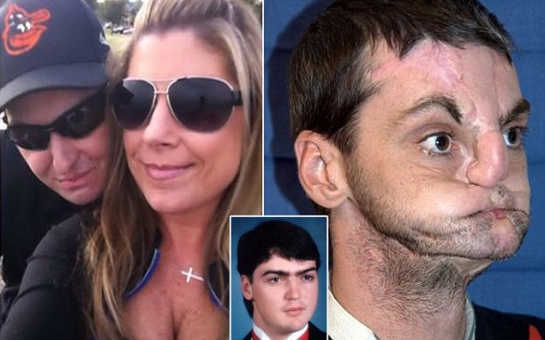 Shotgun victim reveals he’s having to learn how to kiss again - VIDEO