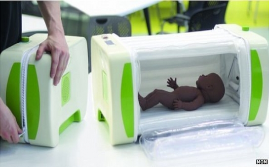 Inflatable baby incubator wins James Dyson Award