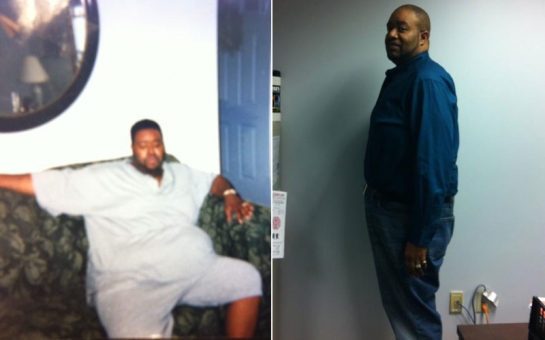 Artist Robert E. Jones to lose 218 pounds