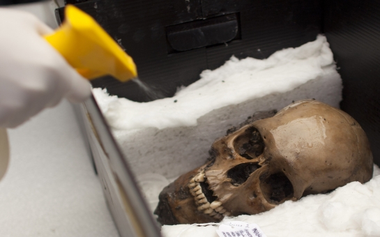 Deformed skull from dark ages unearthed in France