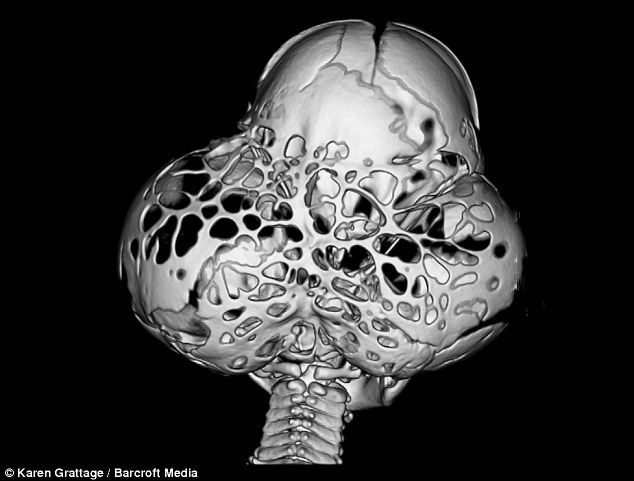 Baby with misshapen head undergoes pioneering surgery - PHOTO