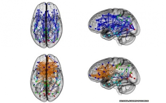 Men and women's brains are 'wired differently'