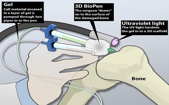 'Bio-pen' could allow doctors to draw-on human cells