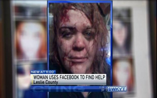 Facebook selfie alerts police and saves life