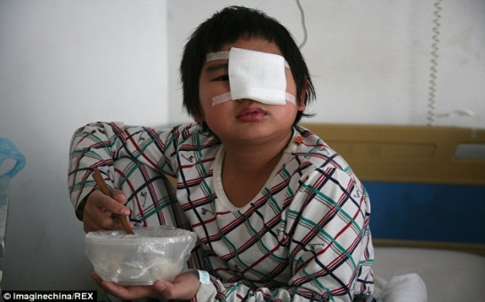 Teacher orders classmates to slap boy in the eye 40 times