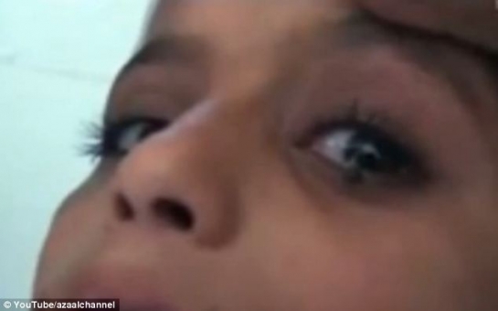 Girl leaves doctors speechless by crying STONES instead of tears - VIDEO