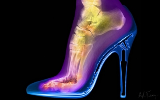 X-ray photography that shows the world in a whole new light