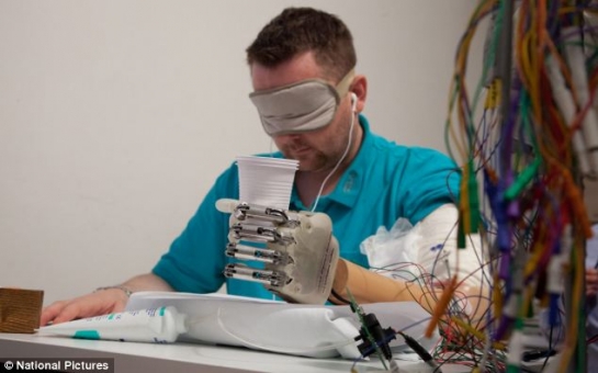 Bionic hand makes patient the first amputee in the world