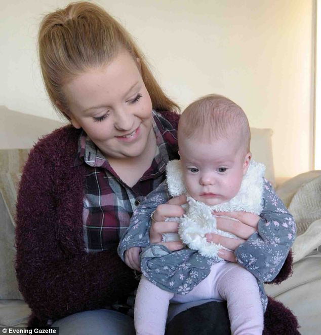 Baby girl born with part of her brain OUTSIDE her skull - PHOTO