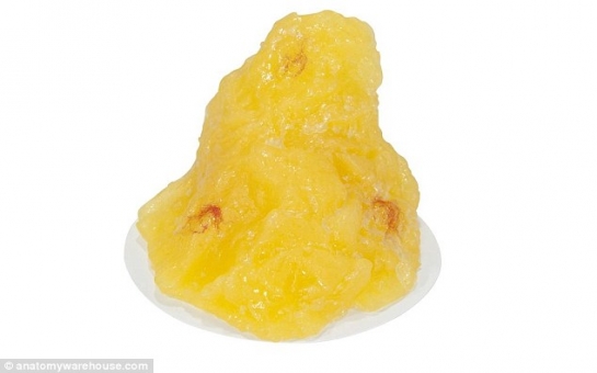 What a single pound of human fat looks like