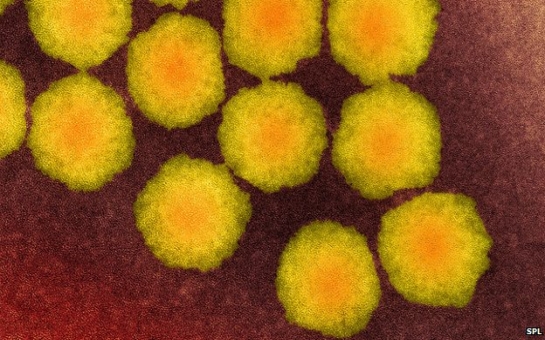 Rare 'polio-like' disease reports