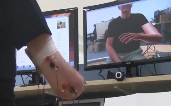 Virtual arm eases phantom limb pain