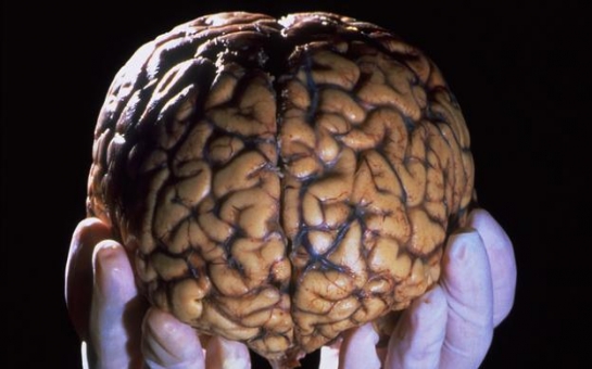 How building a library of brains could save lives