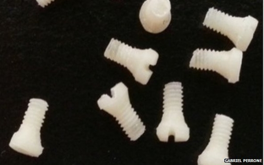 Silk screws used to repair fractures