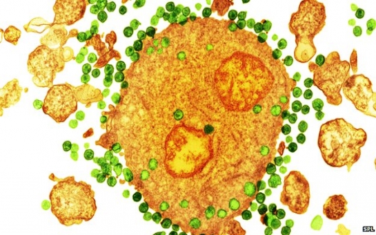 Immune upgrade gives 'HIV shielding'