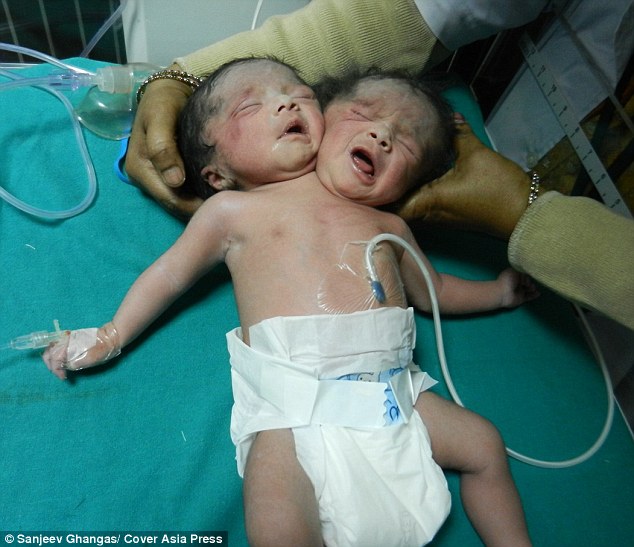 The baby with two heads - PHOTO+VIDEO