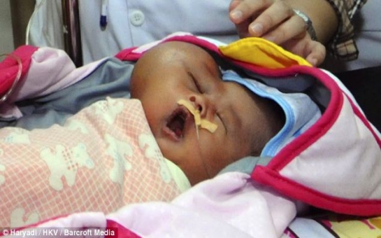 Baby with a heart-shaped head - PHOTO