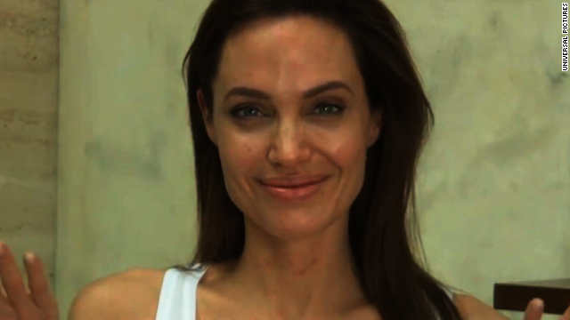 Angelina Jolie's chickenpox explained