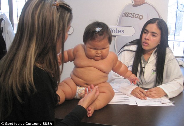 The 10-month-old who weighs as much as a five-year-old