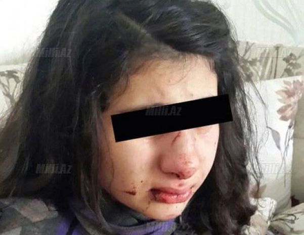 Подробности избиения школьницы в Баку