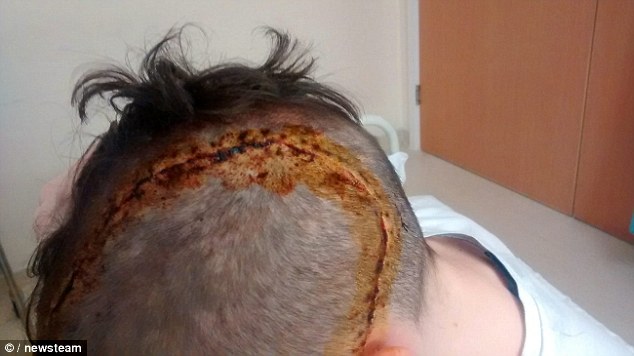 Horrific injuries of 16-year-old boy