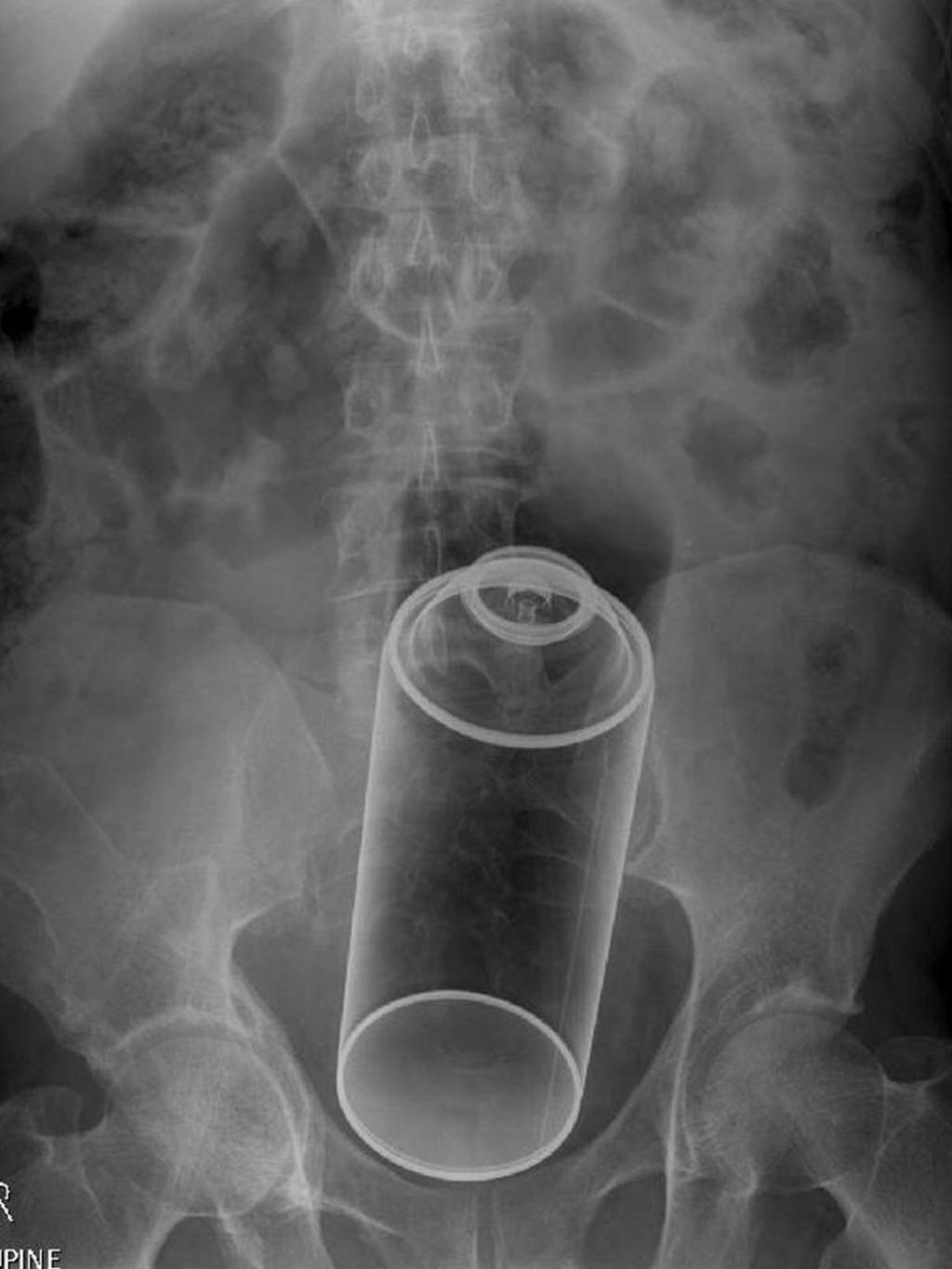 Most unusual X-rays