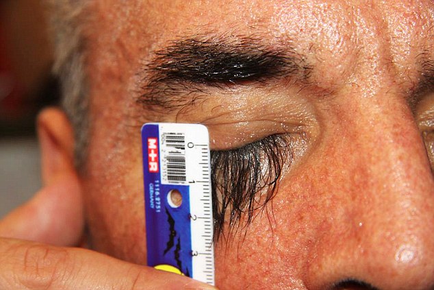 Ukrainian man thinks he has the world's longest eyelashes