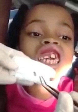 Dentist removing 15 MAGGOTS from inside little girl's gum