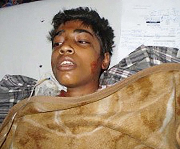 Muslim youths attack child and set him on fire in Pakistan because he is a Christian