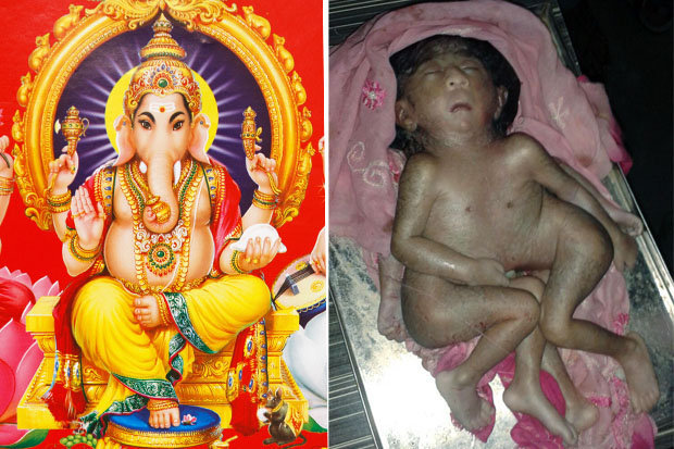 Baby born with EIGHT limbs worshipped as 'Hindu God'