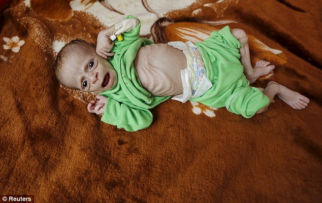 Heartbreaking images reveal the human face of hunger in Yemen