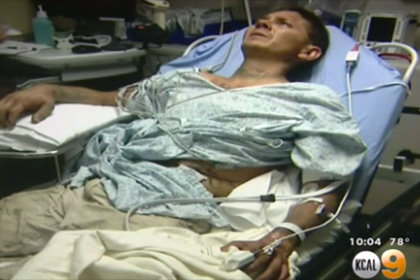 Американец попал в больницу после селфи с гремучей змеей