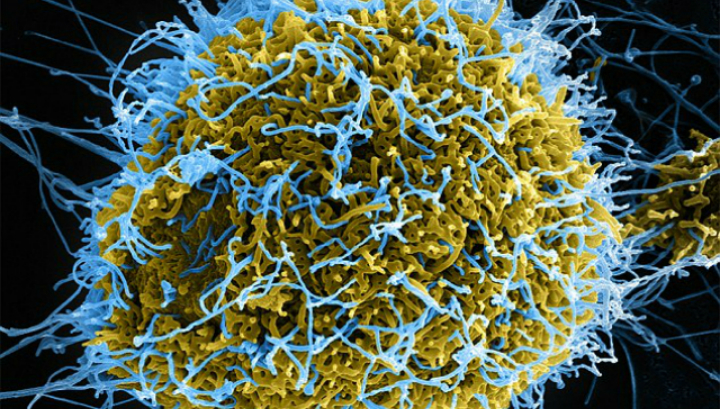 Эбола может жить 9 месяцев