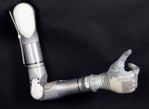 Bionik əl protezi əlləri amputasiya olunan insanlara kömək edəcək