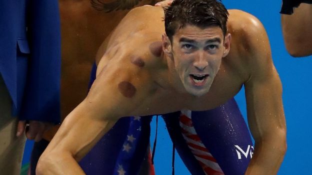 Why are so many Olympians covered in large red circles?