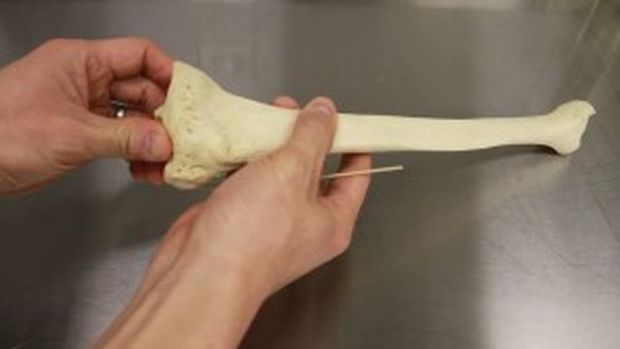 Ученые впервые вырастили костную ткань