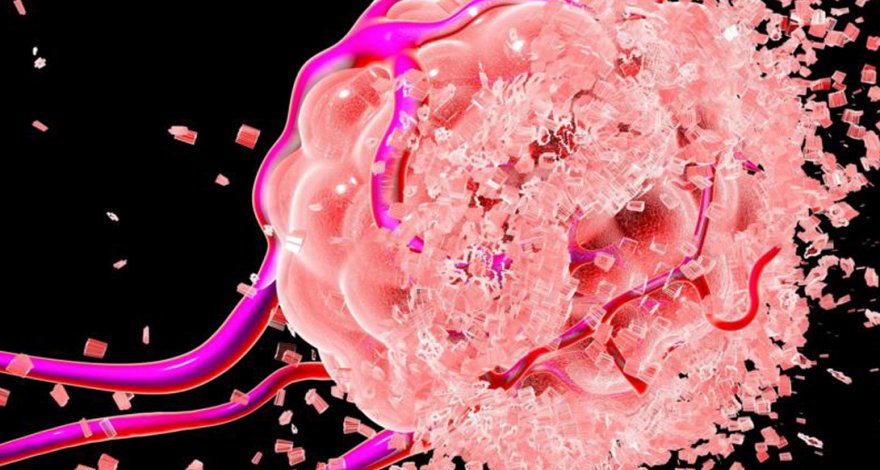 Онкологи выявили причину возникновения рака у мужчин
