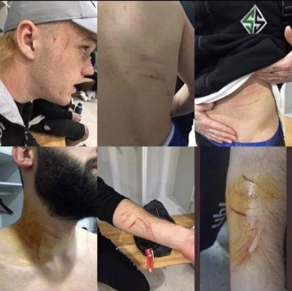 В Турции футболист пронес на поле лезвие и начал резать соперников- Фото