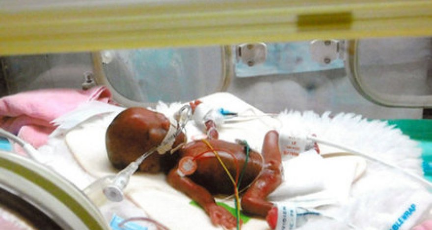 Самого маленького в мире новорожденного мальчика выходили в Японии